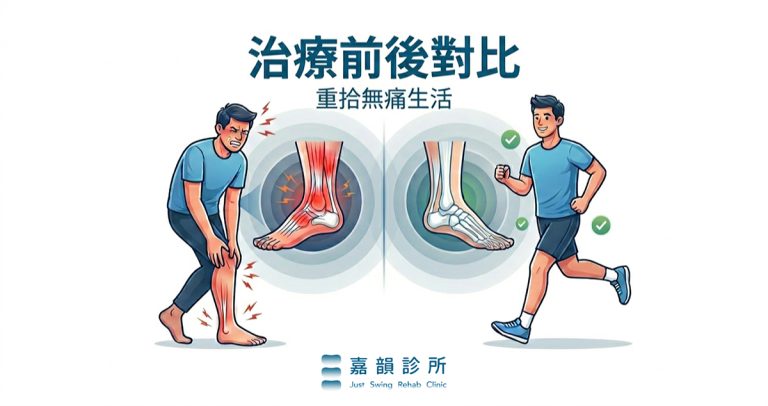 插畫對比圖:左側男性因阿基里斯腱疼痛而跛行,腳踝標示紅色發炎;右側同一人恢復後可以正常跑步。