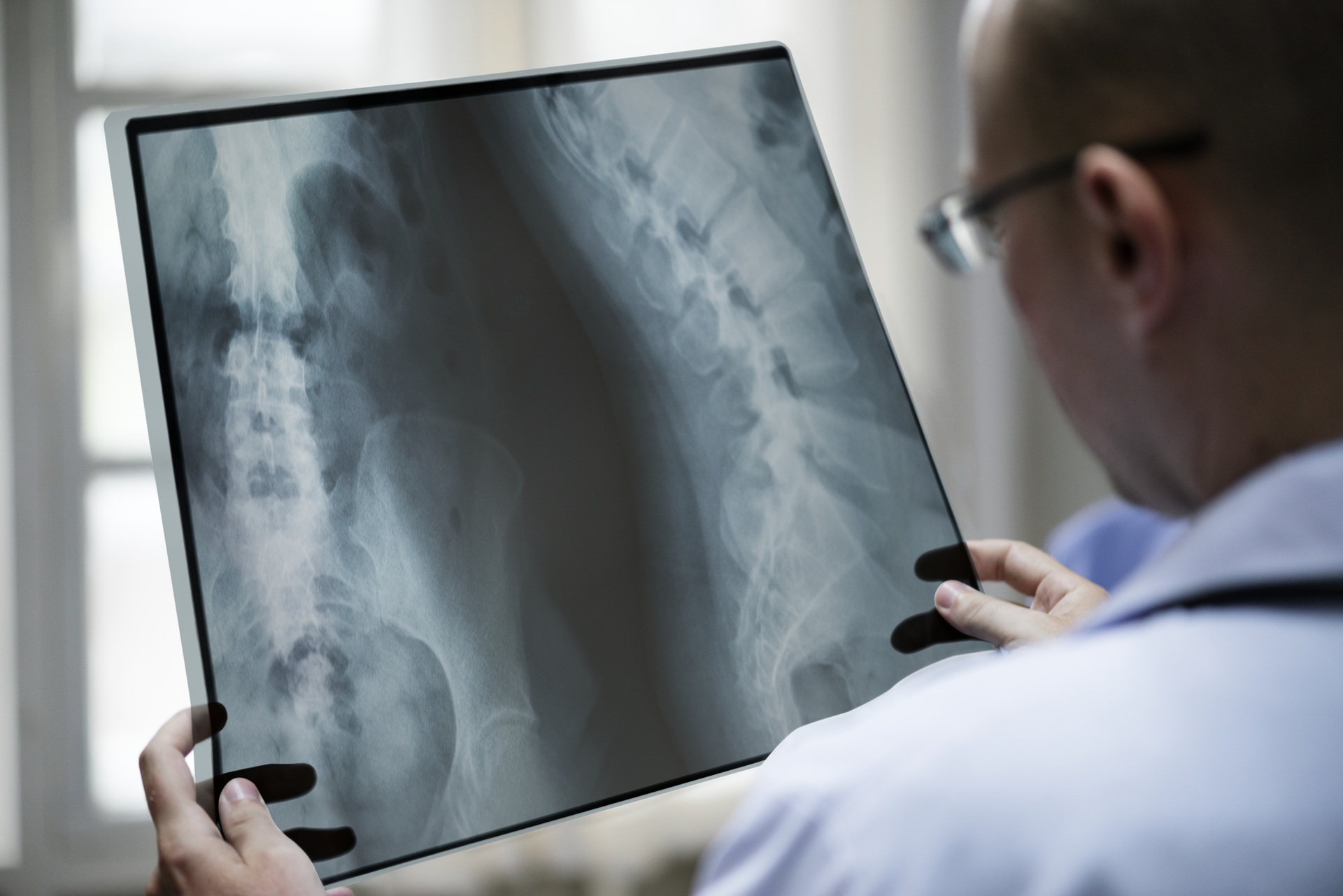 Doctor with a patient's x-ray film