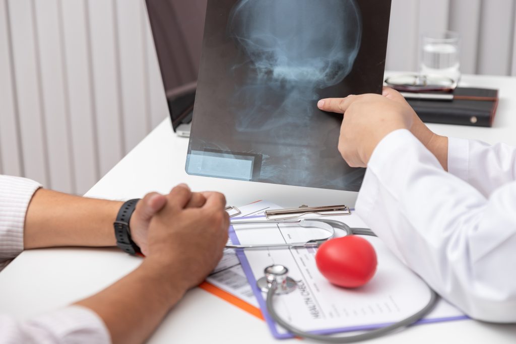 doctor-looking-head-x-ray-film-explain-symptoms-medical-treatment-patient
