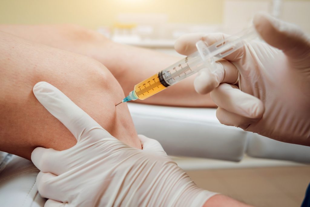 Platelet-rich plasma injection of the knee. Background.